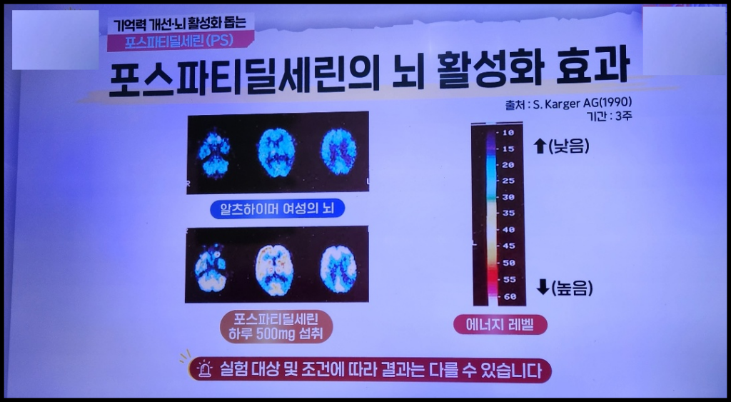 포스타티딜세린-뇌활성화효과-사진