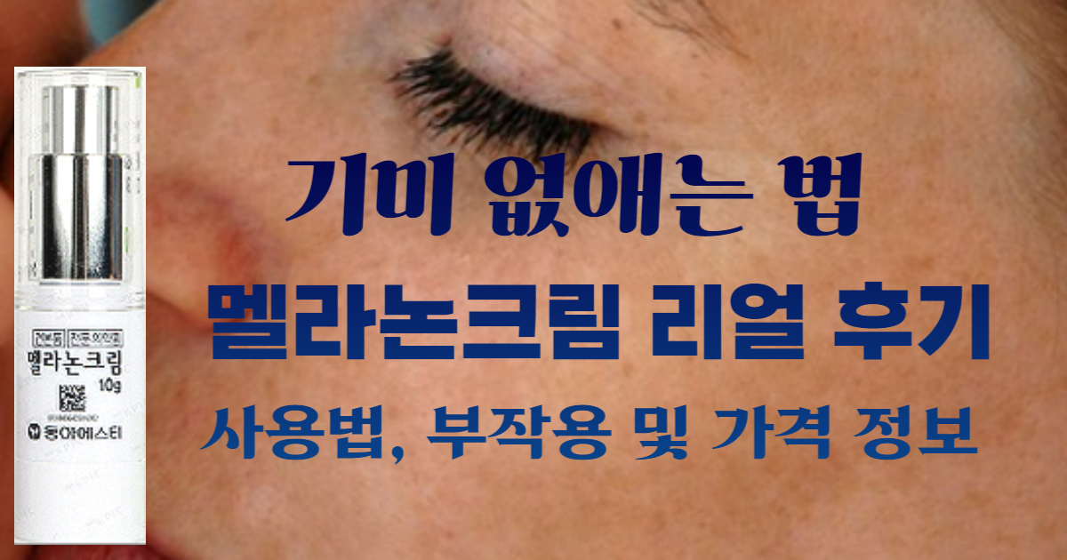 기미 없애는 법 - 멜라논크림 리얼 후기와 사용법, 부작용 및 가격 정보