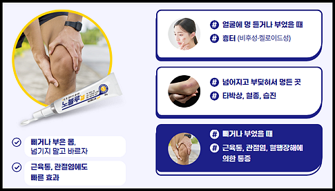 노블루겔 효능-중외제약 홈피