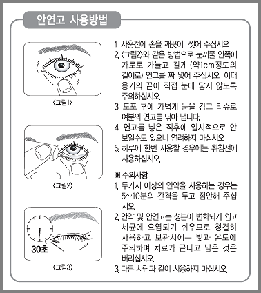 안연고 사용법