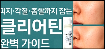 실리실산-여드름